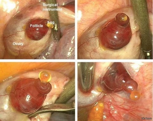 ����� ����� ��������