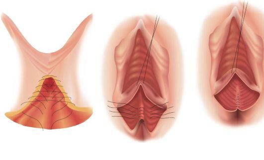 ��� ����� �����