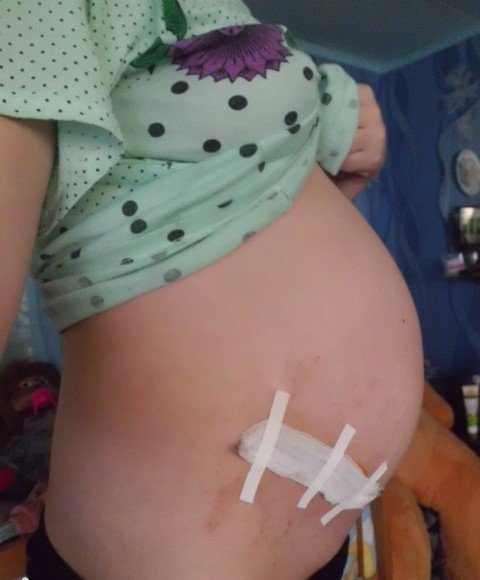 ���������� ��������