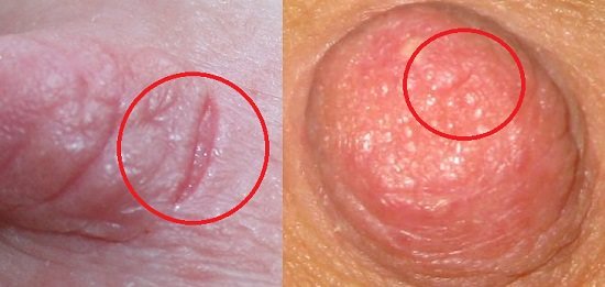 ������� �� �����