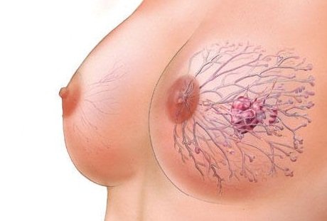 ���������� �������� ������